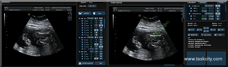 医疗科技超声系统软件界面设计